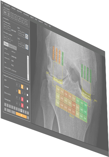 Image Biopsy Lab Software Laptop Image Biopsy Lab Software - Flat Panel Display (1600x981), Png Download