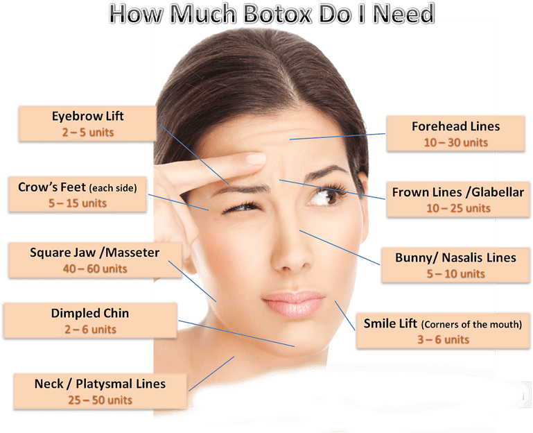 Botox Dosage Chart - Can I Get Botox On My Face (776x646), Png Download