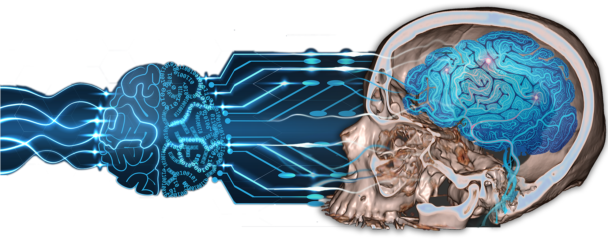 Cloud-based Artificial Intelligence For Medical Imaging - Current Developments In Stroke: Understanding Stroke (2000x791), Png Download