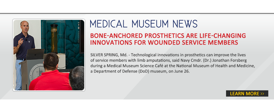Bone Anchored Prosthetics Are Life Changing Innovations - Tread (960x352), Png Download