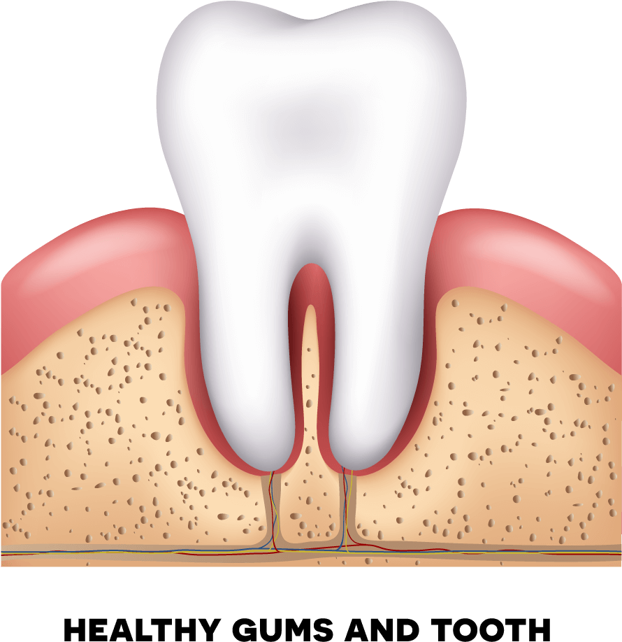 Healthy Gums - Periodontal Disease (930x930), Png Download