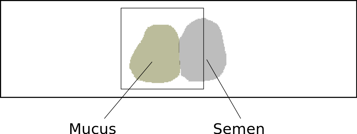 Miller Kurzrok Test (1200x451), Png Download