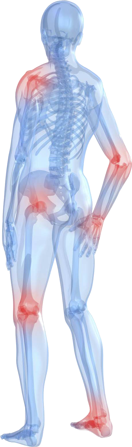 Me First Living Premium Standardized Turmeric Curcumin - Does Rheumatoid Arthritis Hurt (500x1600), Png Download