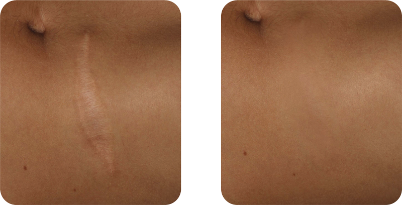 Scars - Wood (800x408), Png Download