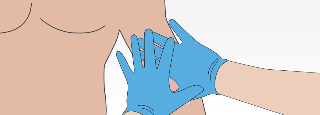 At The End Of Three Minutes, Apply A Pressure Dressing - Illustration (1020x368), Png Download