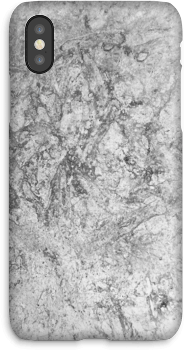 Beautiful Stone - Mobile Phone Case (499x800), Png Download