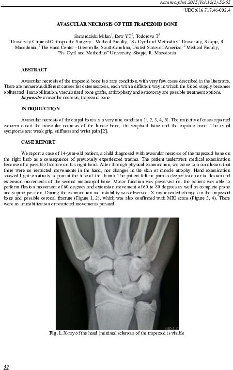 Pdf - Radiography (595x842), Png Download