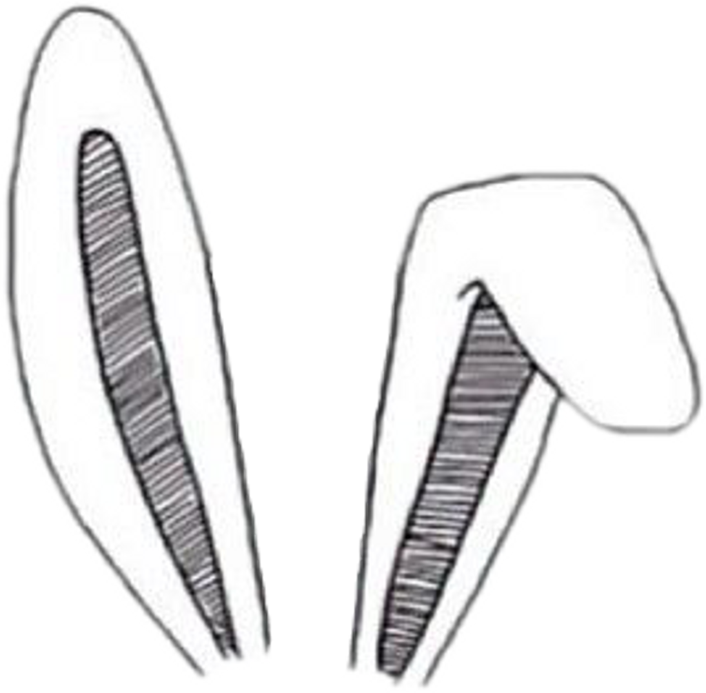 Bunnyears Sticker - Transparent Bunny Ears Clipart (1024x1005), Png Download