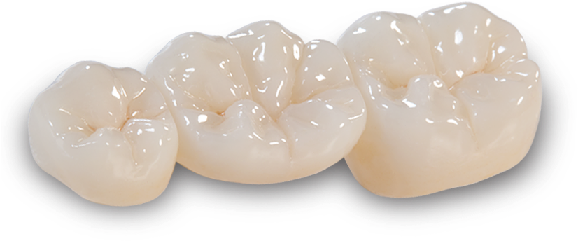 Bruxzir Anterior Crowns & Bridges - Crown (825x464), Png Download
