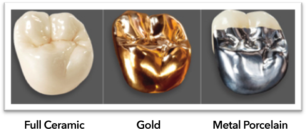 Crowns - Bruxzir Crown (636x300), Png Download