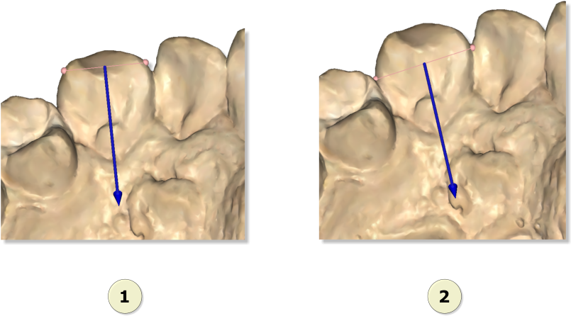 File - Maestro3d - Dental - Studio - Mesio - Distal3 - Diagram (811x449), Png Download