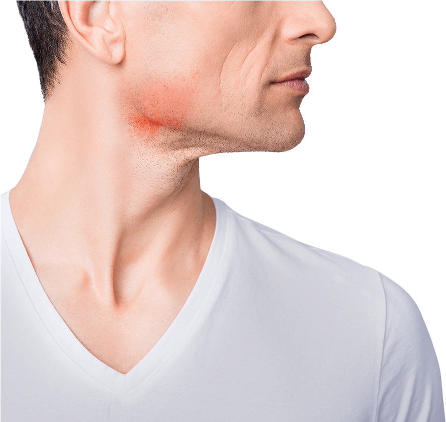 Transparent Skin Causes Transparent Background - Male (1584x840), Png Download