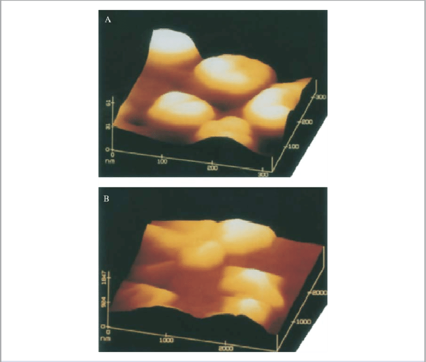 Afm Images Of Ha And Cppd Crystals From A Patient With - Calcium Pyrophosphate Dihydrate Crystal Deposition (850x723), Png Download