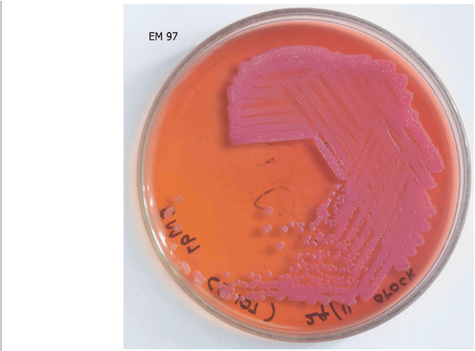 Pseudomallei Cultured In Macconkey Agar - Coin (850x504), Png Download